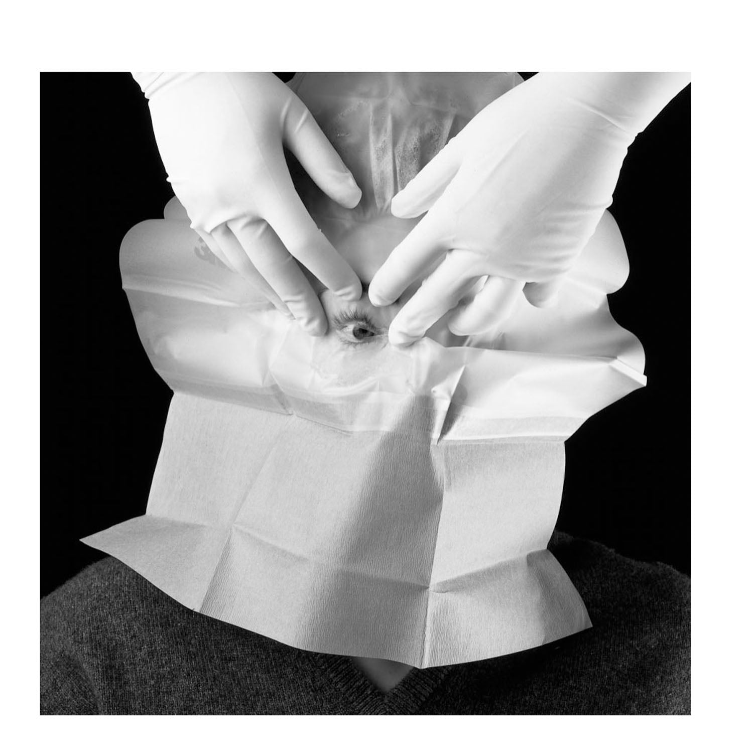 1022 - Solventum Corporation - Refractive Drape, 15" x 10", 20/bx, 4 bx/cs (Continental US+HI Only) (Item is Short-Dated; Non-Returnable) , cs