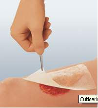 554929 - Cuticerin - Cuticerin Oil Emulsion Impregnated Dressing Rectangle 3 X 8 Inch Sterile, 66045561, Pack of 1, (EA)