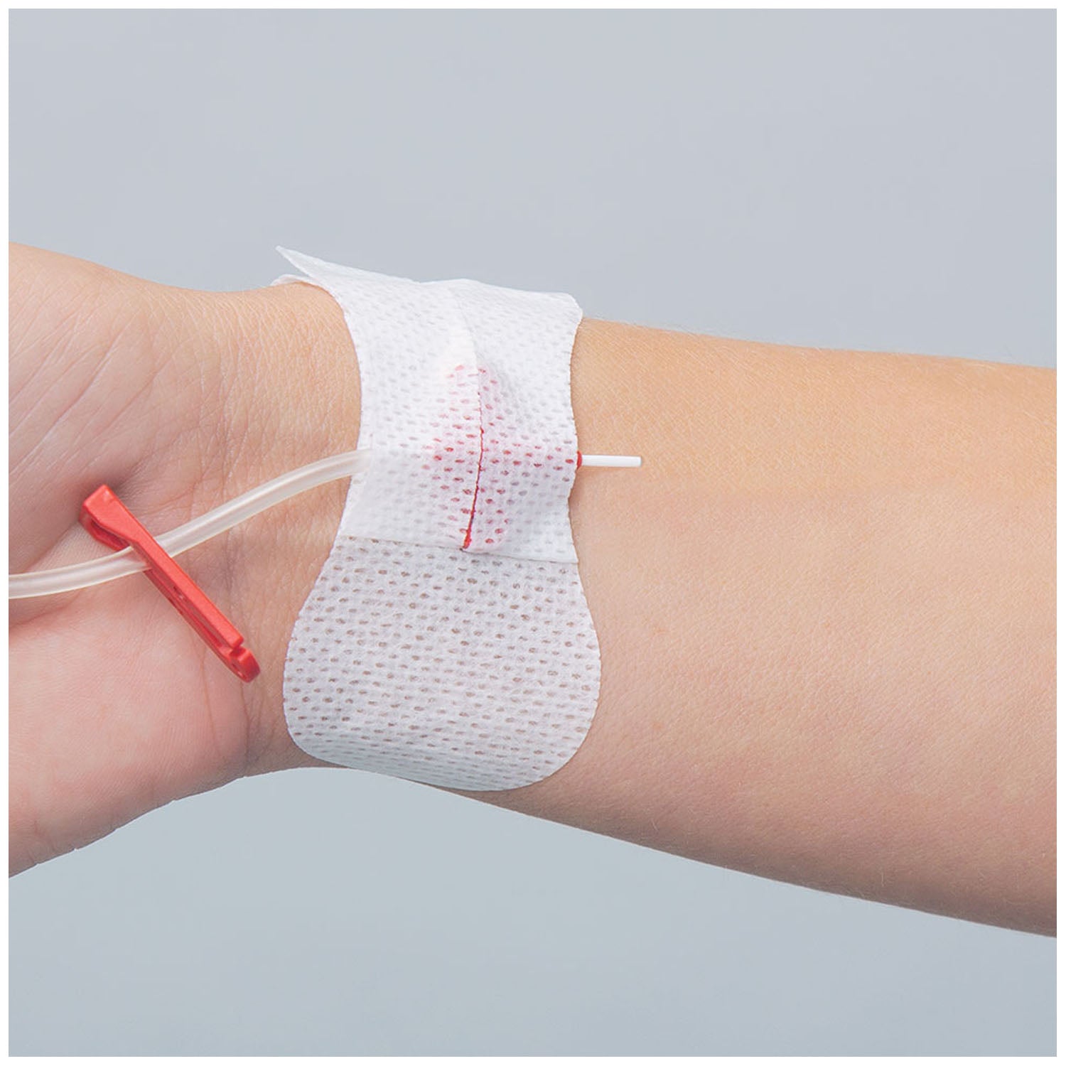 3300MIV - TIDI Products, LLC - Securement Device, Universal Winged Peripheral IV & Arterial Catheter, Sterile, Individually Packaged with 1 Tape Strip, 100/bx , bx