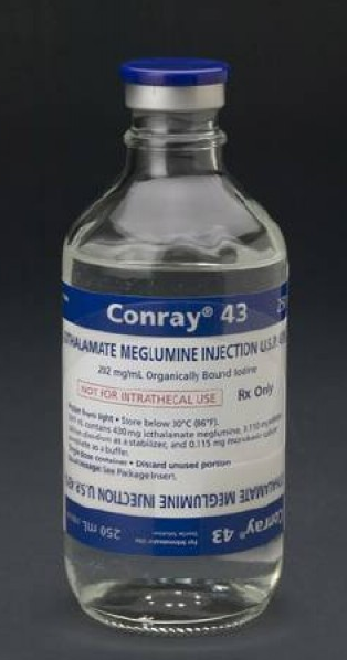 Conray 43 iothalamate meglumine injection vial, 250 mL, medical diagnostic contrast solution