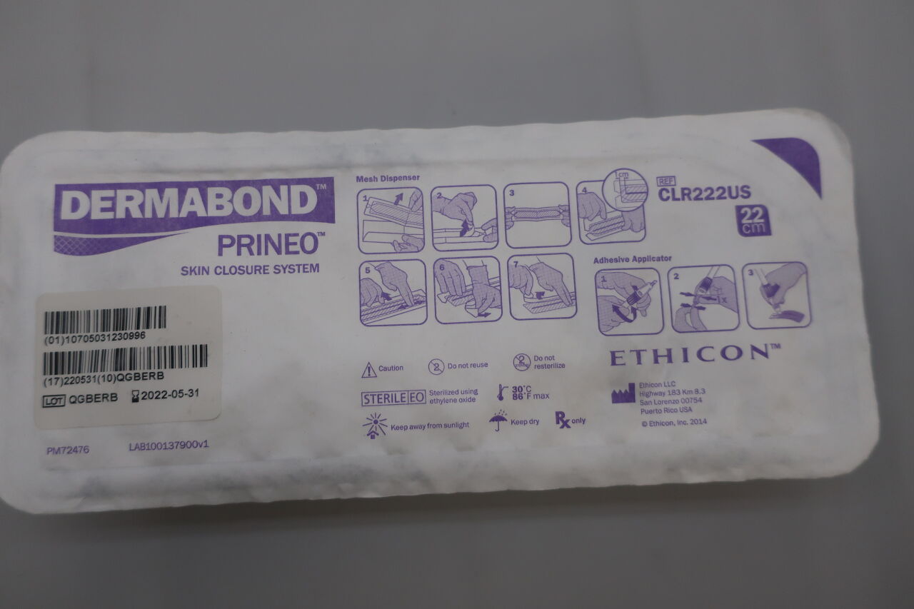 CLR222US - ETHICON - Dermabond Prineo Skin Closure System, 22 cm, Violet, (EA) - ( Expiry Date: 2026-01-31 )