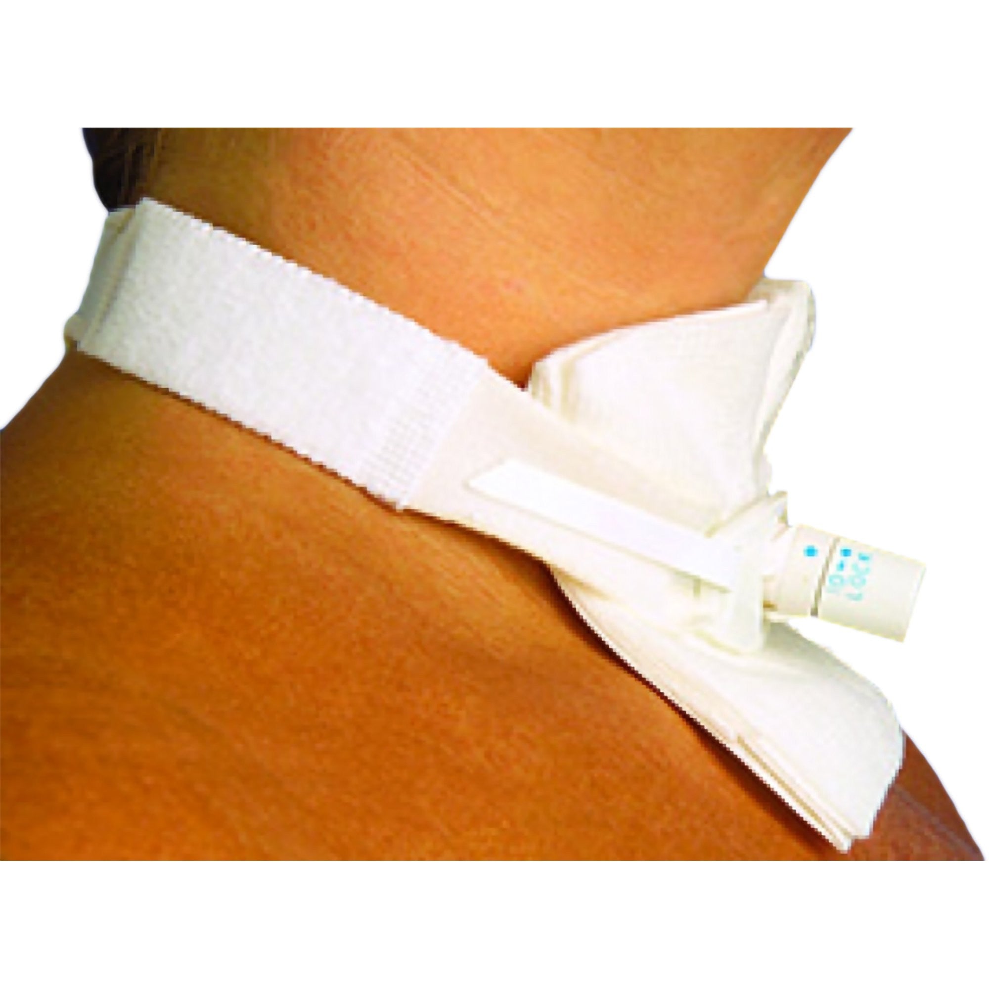 581503 - PEDI-TIE - Tracheostomy Tube Neckband Pedi-Tie 501P Box of 20, (BX)