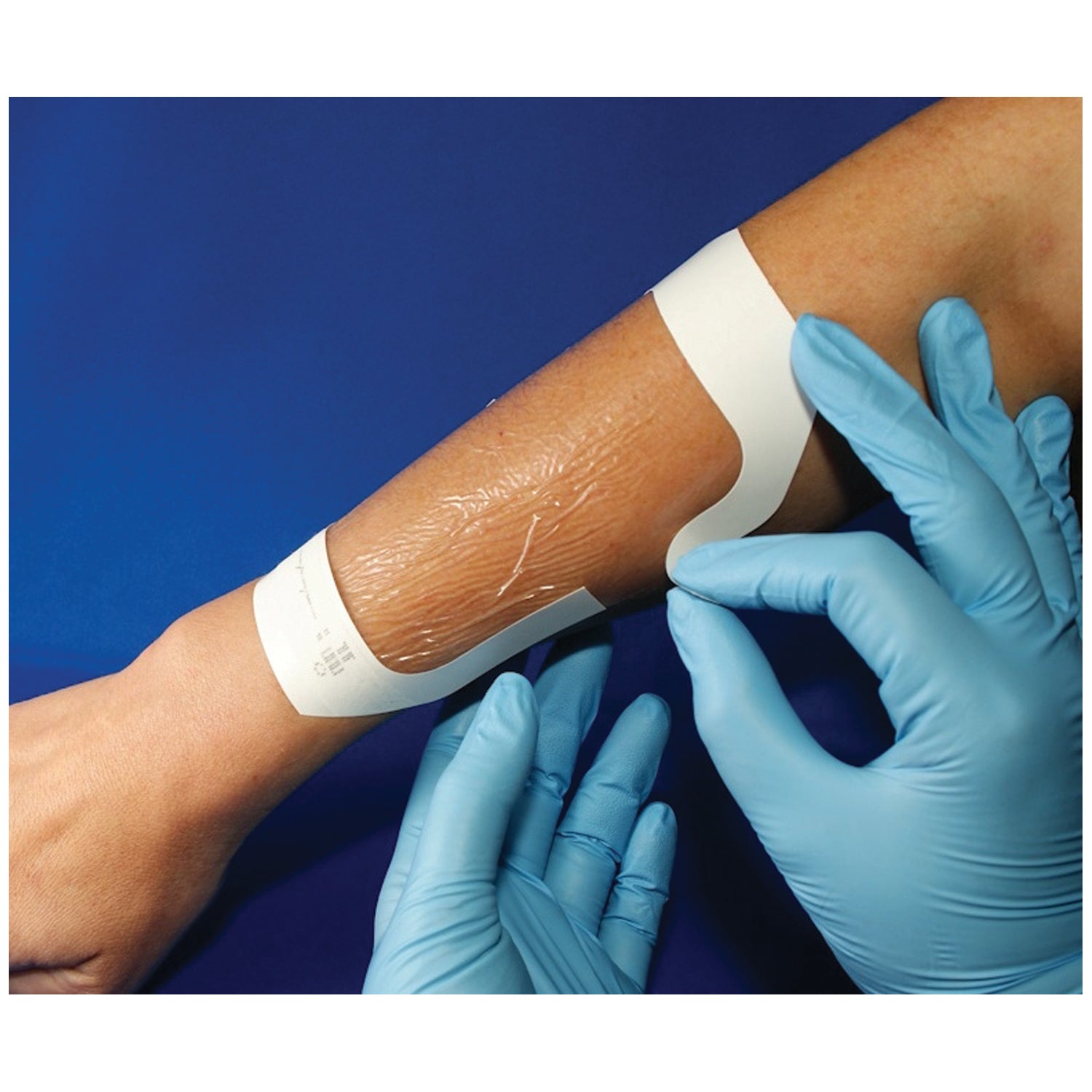 A60044 - AMD-Medicom - Apósito transparente, 4" x 4¾", 40/paquete, 4/paquete, caja