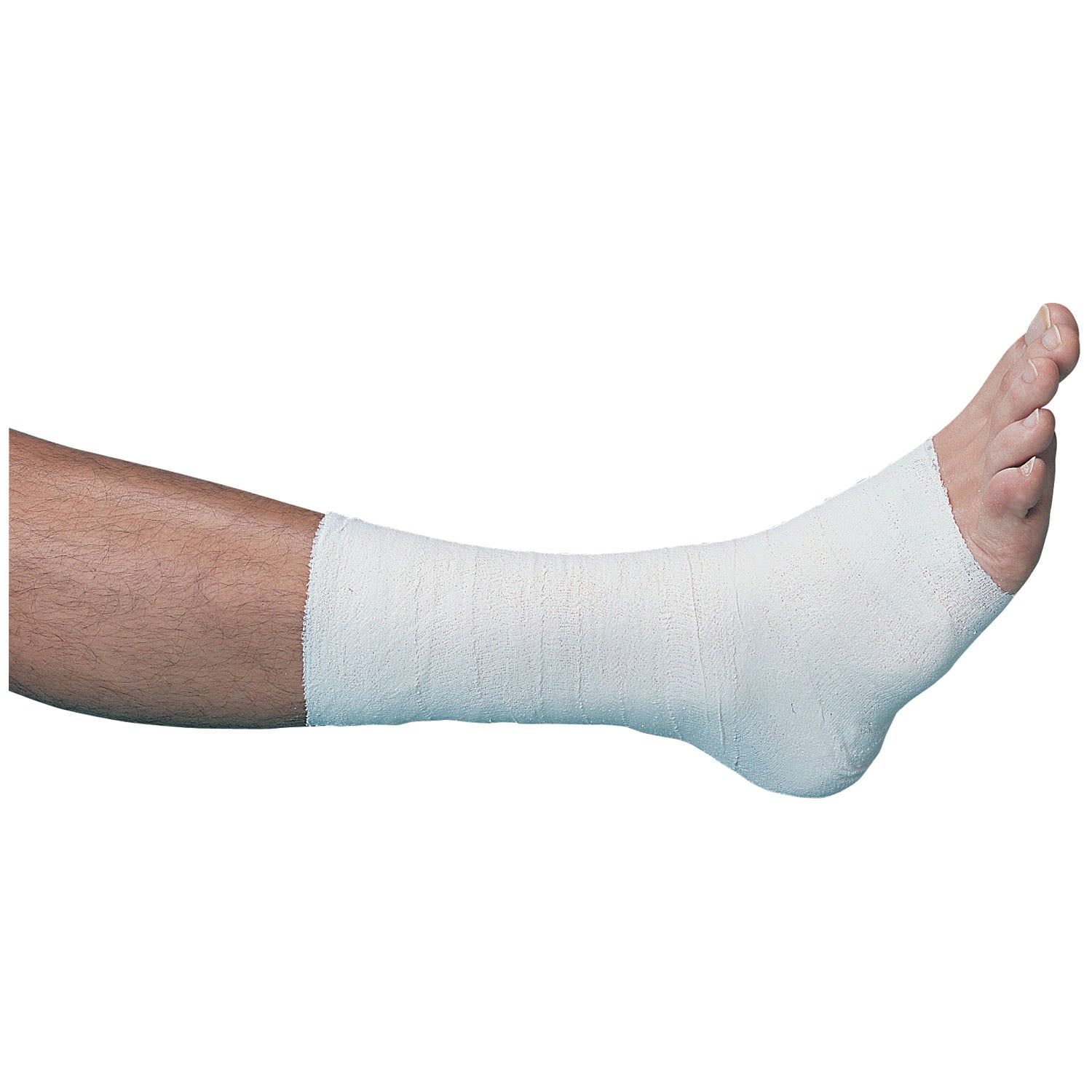 01053 - BSN Medical/Jobst - Bota Unna, 4" x 10 yardas (020323) (solo EE. UU. continentales), c/u