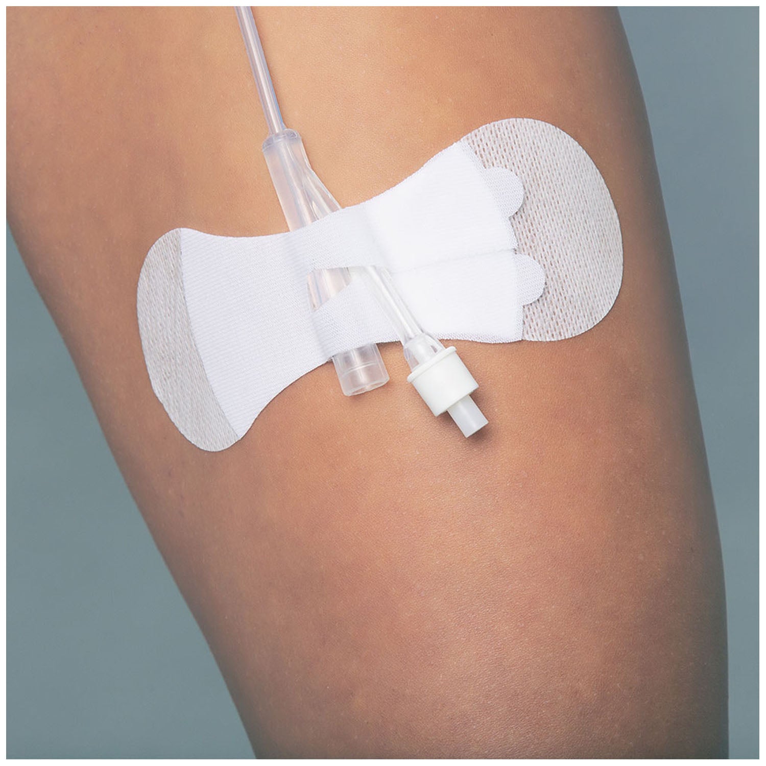3400LFC - TIDI Products, LLC - Securement Device, Universal, Foley, Large, Sterile, Individually Packaged, 100/bx    , bx